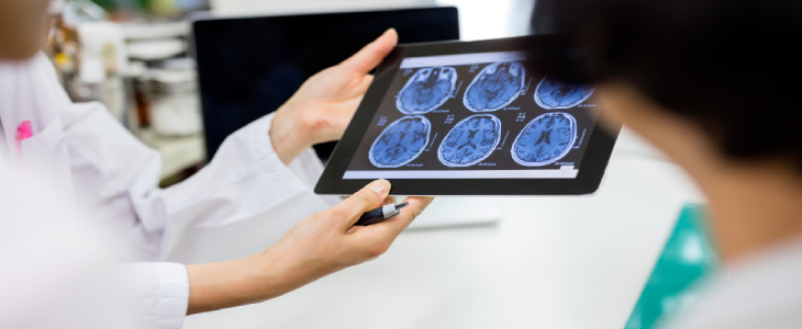 Doctors analyzing a brain scan for a traumatic brain injury