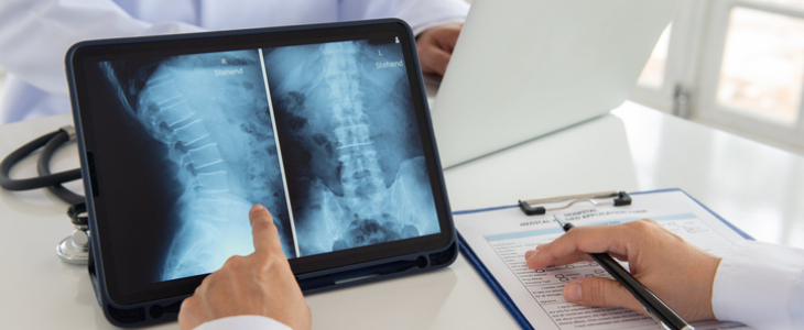 Doctor pointing at a spinal cord injury in an x-ray scan