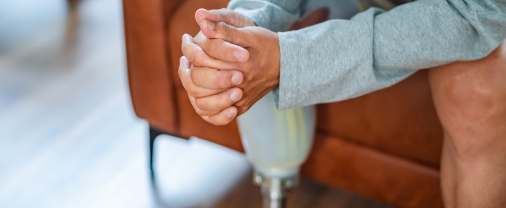 Man with an amputation after a personal injury accident attorney